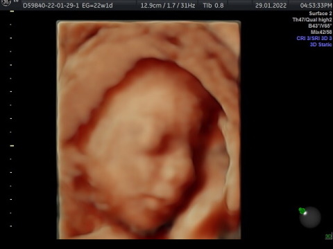 ultrasonido-estructural1-3