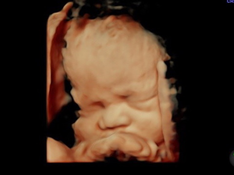 ultrasonido-estructural2