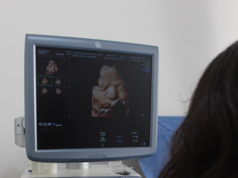 ultrasonido-estructural4